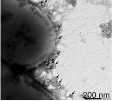 図１．ノロウイルス吸着性腸内細菌の電子顕微鏡写真。矢印がノロウイルス粒子。